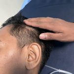 Kasus Penganiayaan Anak Bawah Umur Kembali Terjadi di Wilkum Polres Tanah Datar, Gakkum Terkesan Lalai Tangani Perkara  ‎
